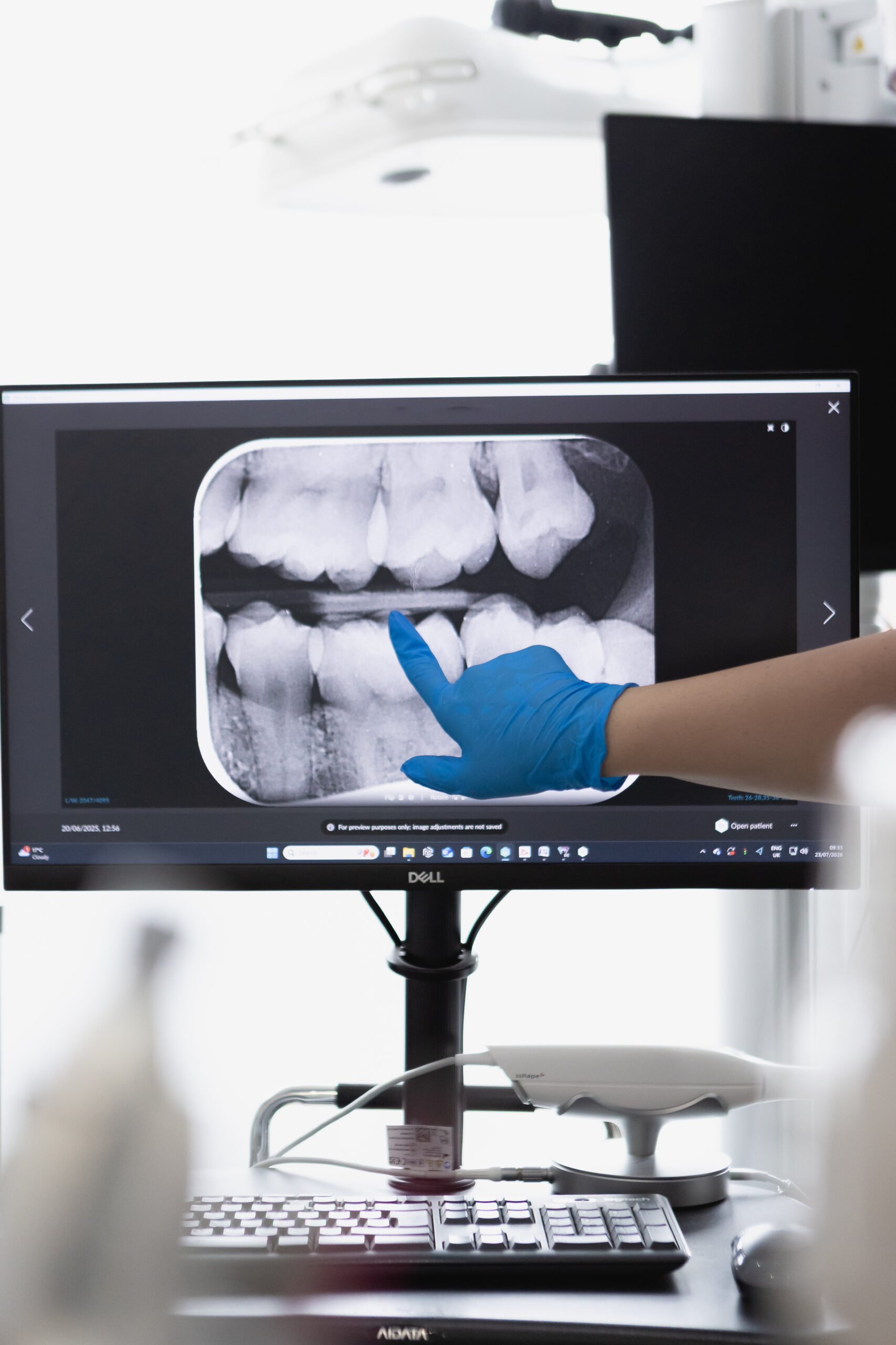Cosmetic Dentistry